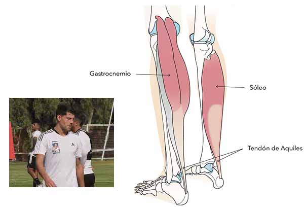 Músculo sóleo